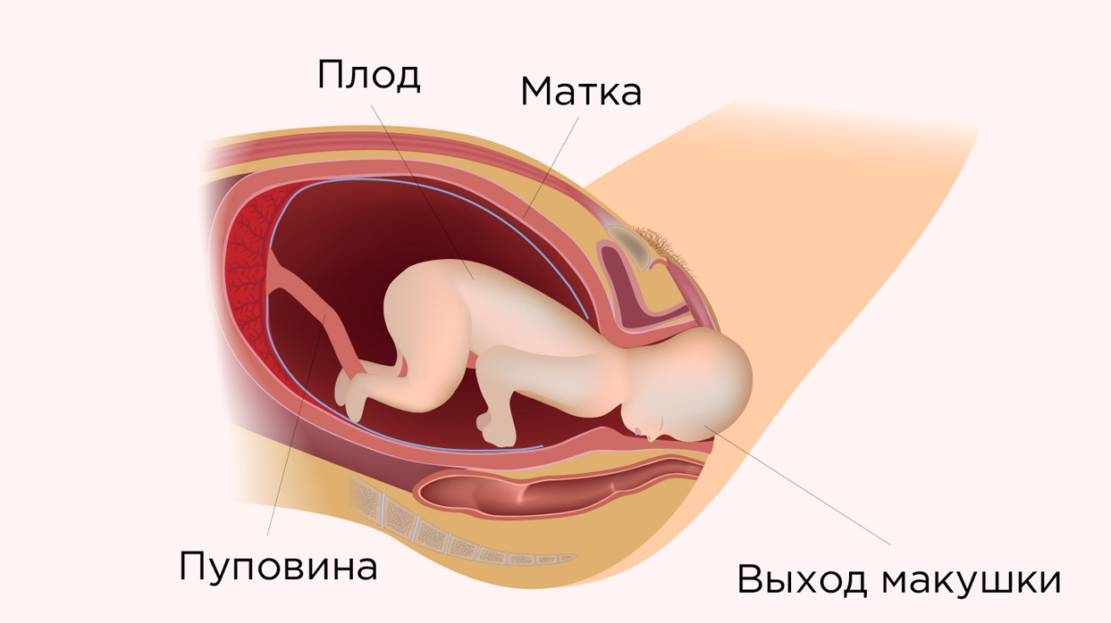  Рождение плода.