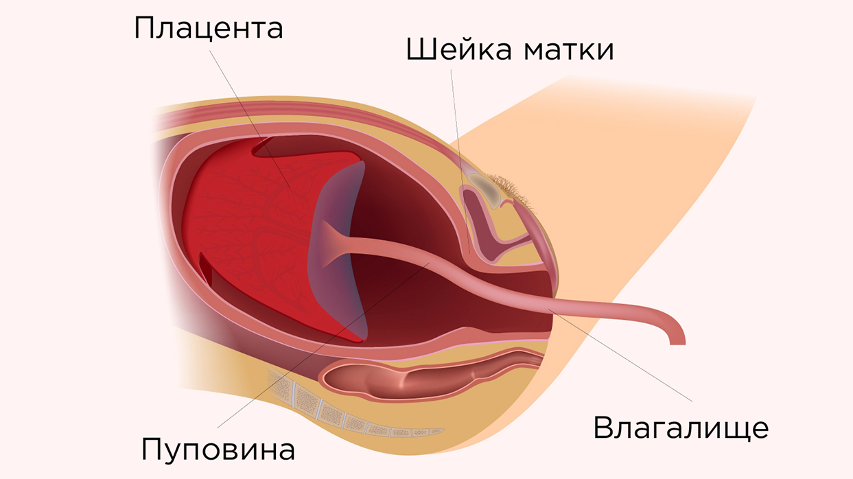 Рождение последа.