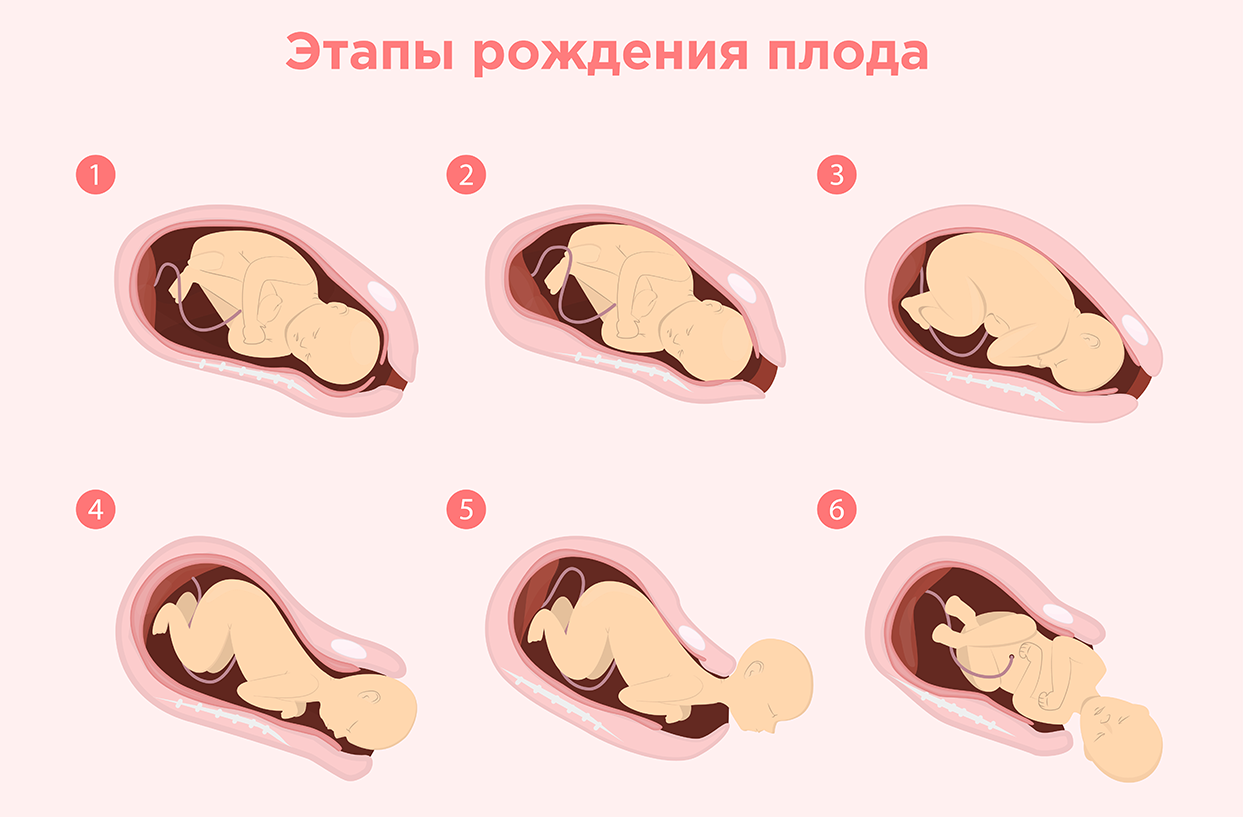 Этапы рождения плода.