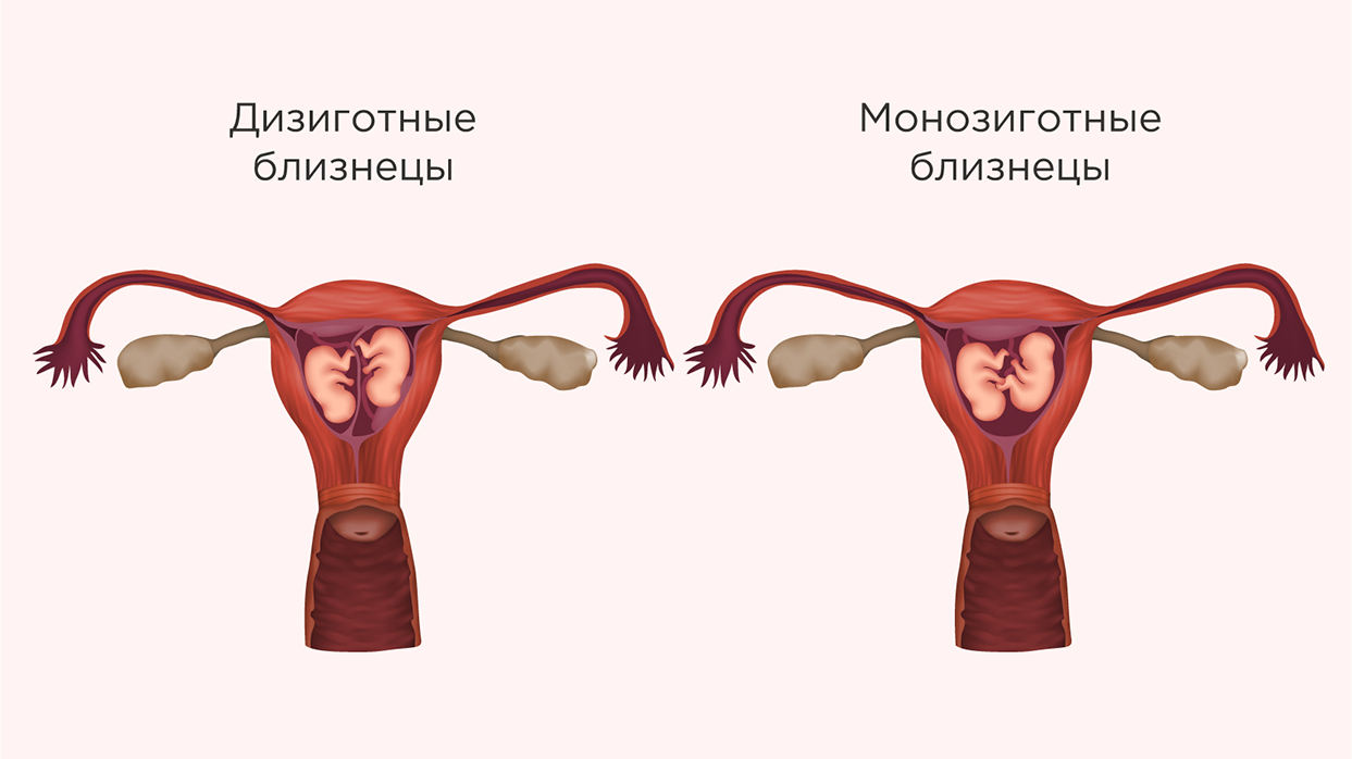 Типы близнецов.