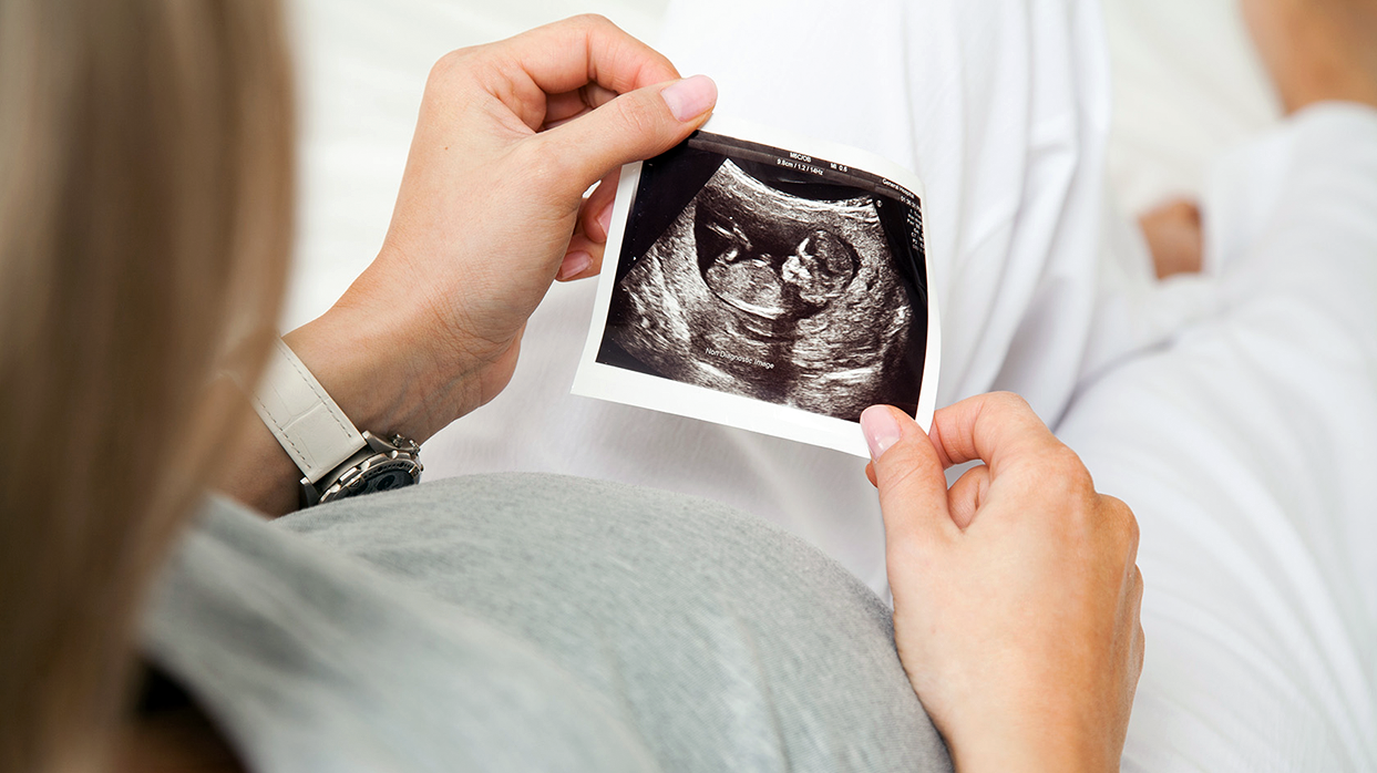 Сроки диагностики обвития пуповины.