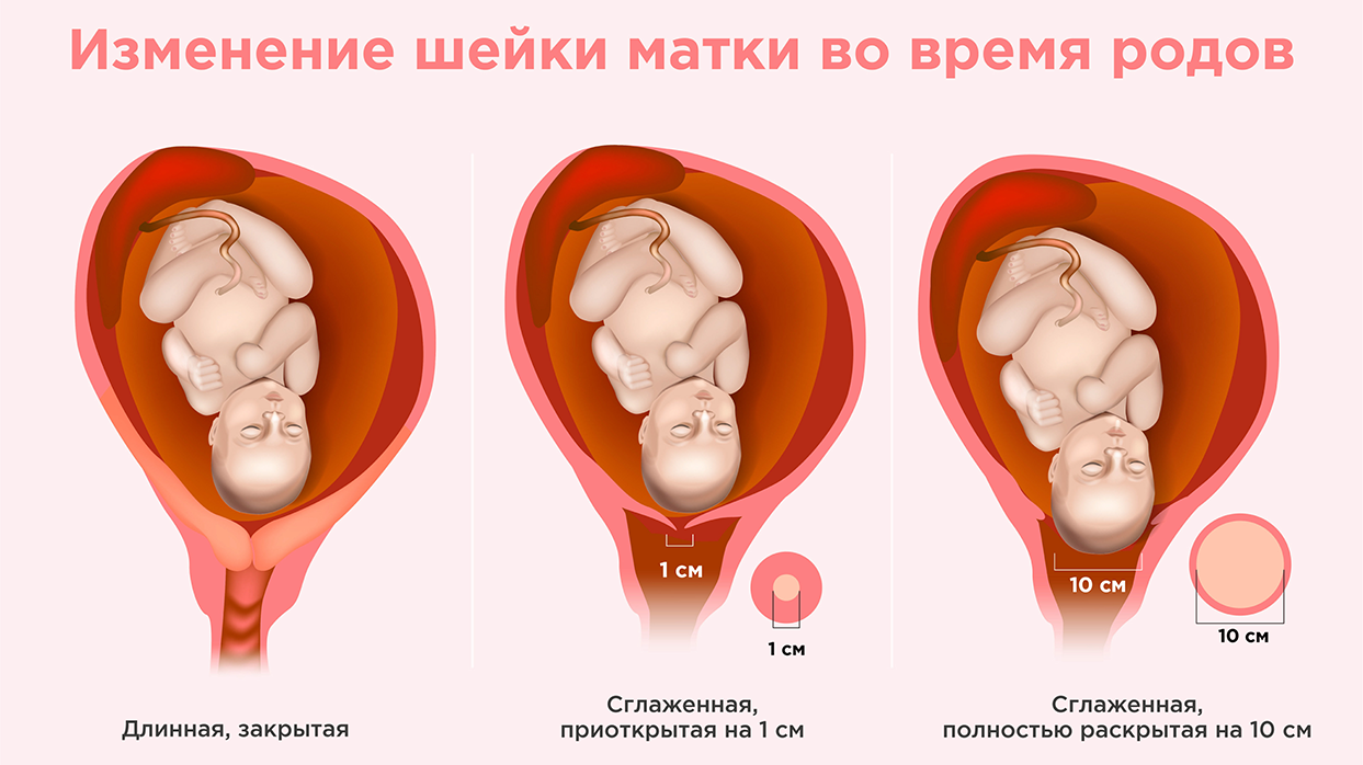 Слизистая пробка